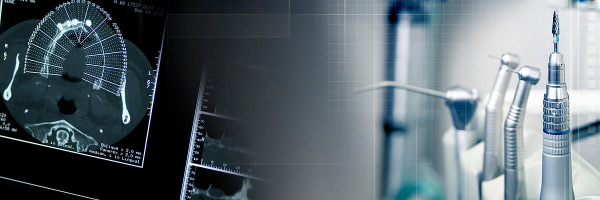 Katy Will I Need a Bone Graft for Dental Implants?