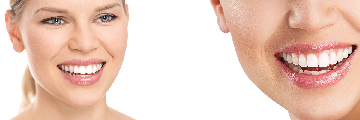 Katy Cosmetic Dental Care