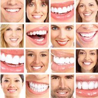 Dental Cosmetics
