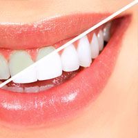 Professional Teeth Whitening