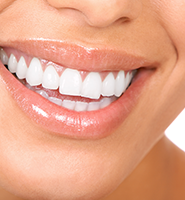 Teeth Whitening Services Katy, TX
